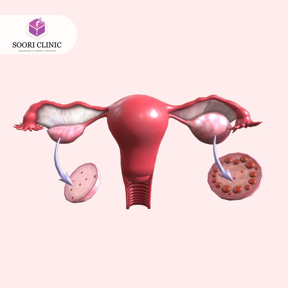 مکمل گیاهی تنظیم پریود و قاعدگی 